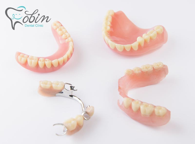 دنتور می تواند آسیب چند دندان، همه دندان ها و حتی لثه ها را پوشش دهد.
